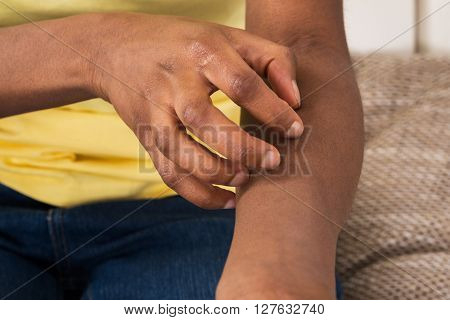 Woman Suffering From Itching