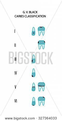 Caries Type Classification Black Six Hand Drawn Vector Illustration In Cartoon Comic Style