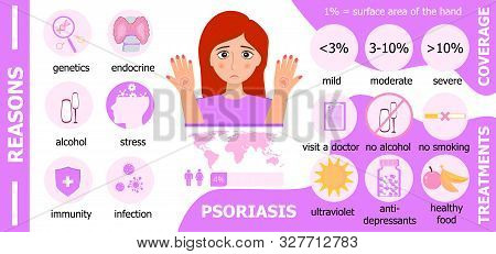 Psoriasis Infographics. Reasons And Treatments And Coverage Are Shown.