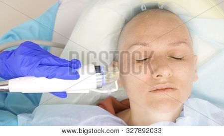 Close-up. Microneedle Rf Lifting Procedure. Hardware Cosmetology. Beautician Conducts A Facial Rejuv