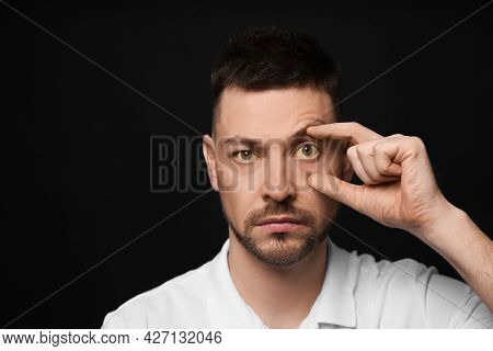 Man Checking His Health Condition On Black Background, Space For Text. Yellow Eyes As Symptom Of Pro
