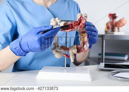 Gastroenterologist Showing Human Colon Model At Table In Clinic, Closeup