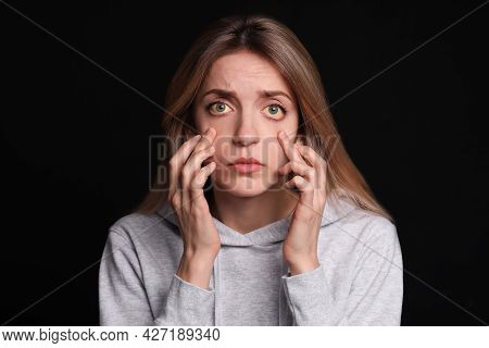 Woman Checking Her Health Condition On Black Background. Yellow Eyes As Symptom Of Problems With Liv