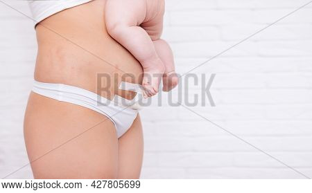 Slim And Fit Figure After Cesarean Section. A Small Child On The Stomach Of A Woman After A Cesarean