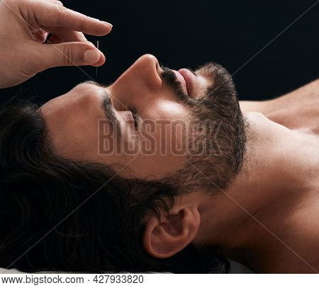 Acupuncture Treatment For Migraines And Headaches. Close-up Of Reflexologist Hand With Acupuncture N