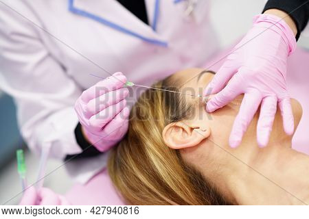 Doctor Injecting Pdo Suture Treatment Threads Into The Face Of A Woman.