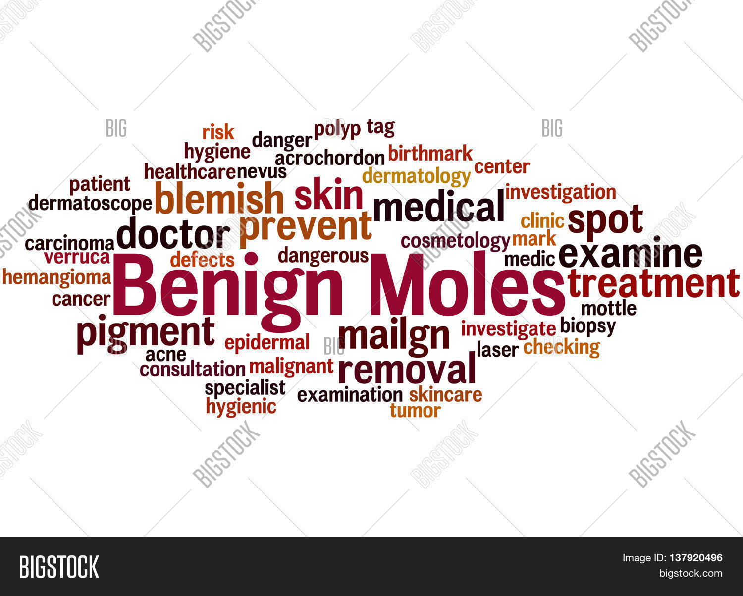 Benign Moles, Word Image & Photo (Free Trial) | Bigstock