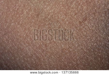 Human Skin With Hair.
