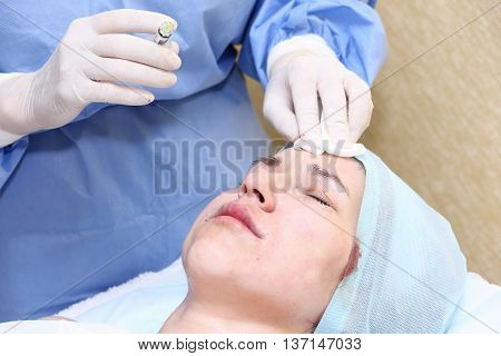 Bio-revitalization With Hyaluronic Acid Treatment Of Mimic Wrinkles.