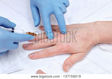 Anti-age injection therapy. Hand rejuvenation in clinic