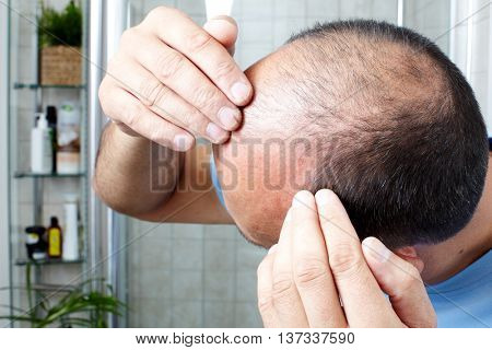 Hair loss.