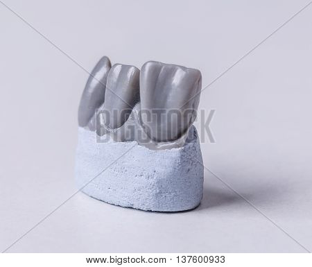 Artificial Tooth