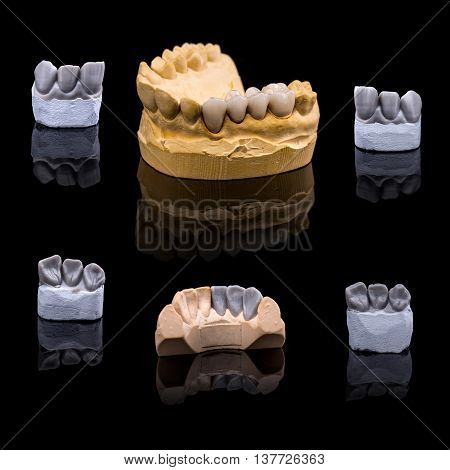 Artificial tooth plaster and wax models, studio shot