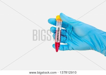 Test-tube With Blood Sample For Tuberculosis Test