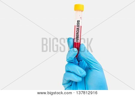 Test-tube With Blood Sample For Tuberculosis Test
