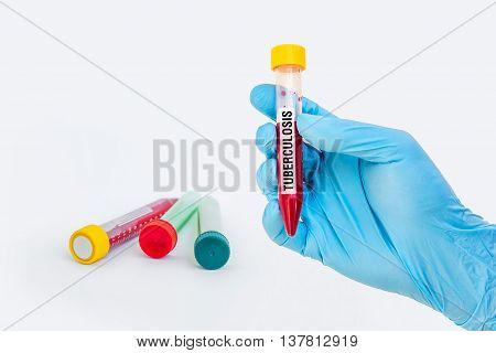 Test-tube With Blood Sample For Tuberculosis Test