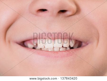 Close-up of young boy mouth with white teeth