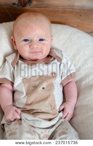 Traces Of An Allergy On The Baby Cheeks, Marbling Of The Skin On The Hands