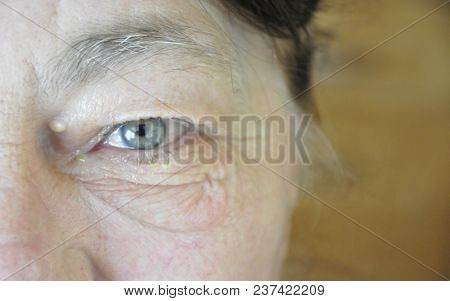 The Camera Captured Old Woman Eye Looking