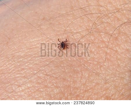 Tick Ixodes persulcatus walking on human skin closeup