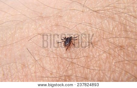 Tick Ixodes persulcatus walking on human skin closeup