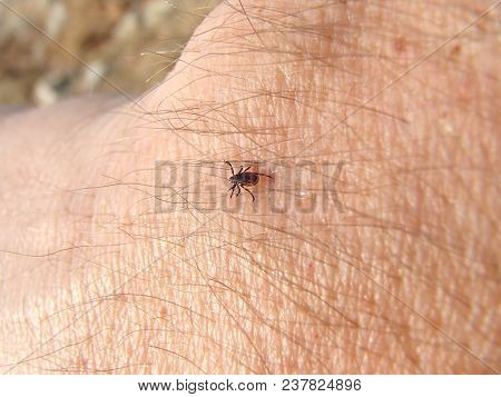 Tick Ixodes persulcatus walking on human skin closeup