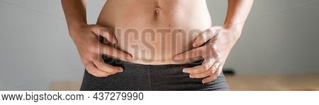 Woman Abdomen With Cesarean Scar. Home Candid Lifestyle. C Section Surgery For Pregnant Woman. Recov