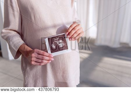 Pregnant Young Woman Holds An Ultrasound Scan In Hands, The Fetus Is Visible In The Photo.