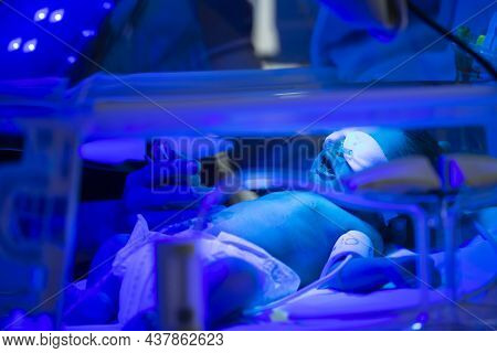 Newborn Child Baby Having A Treatment For Jaundice Under Ultraviolet Light In Incubator. A Neonatal 