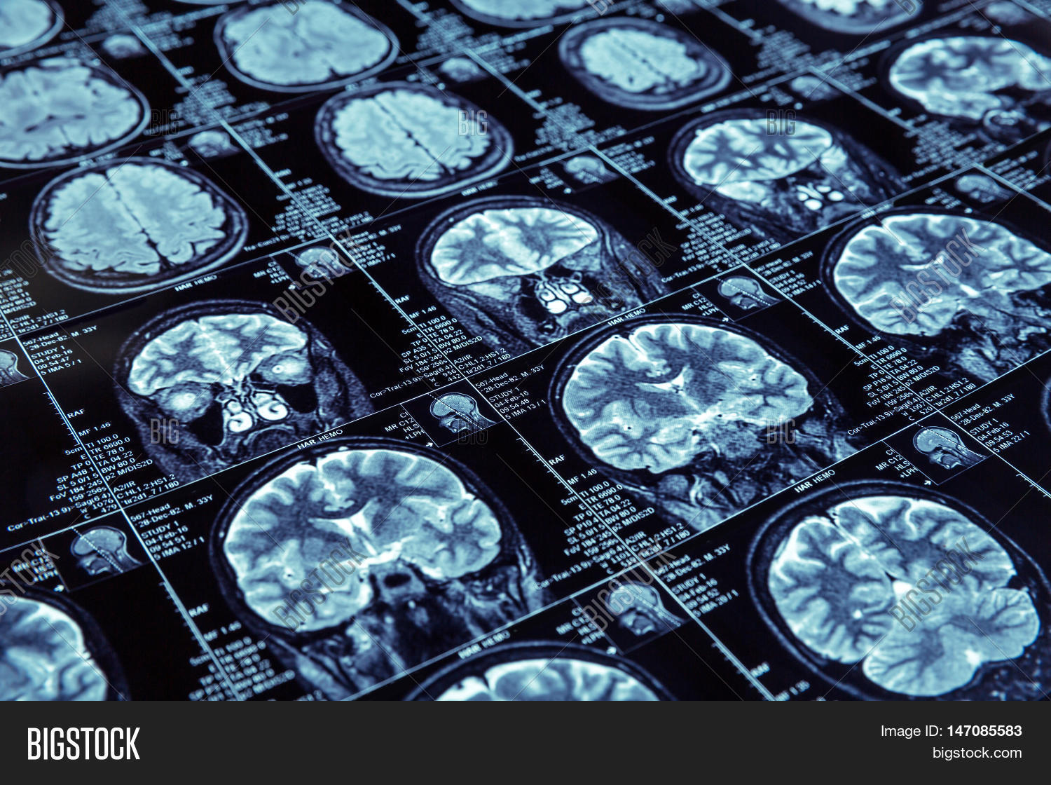 Resonance Image & Photo (Free Trial) Bigstock