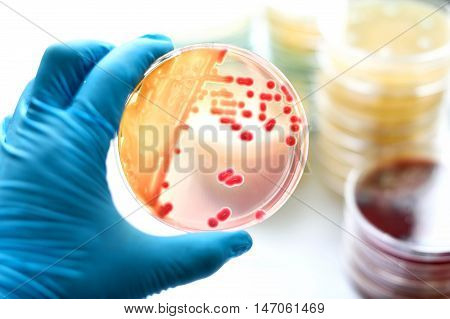 Colonies of bacteria in MacConkey agar (culture medium plate)
