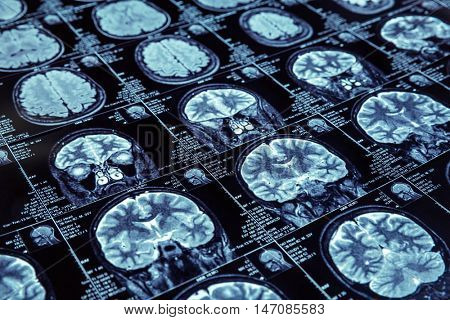 Magnetic resonance imaging