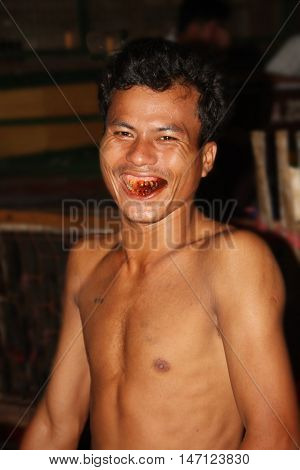 Yangon, Myanmar - November 5, 2011: Portrait of a kind and smiling man, revealing the effects of the prolonged use of betel nut upon the teeth and general oral health.