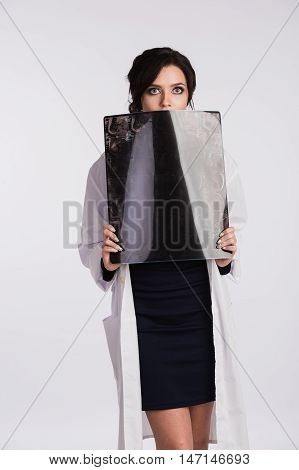 Surprised and very excited female doctor looking at a lungs or torso xray, fluorography.