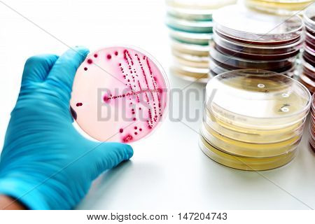 Colonies of bacteria in MacConkey agar (culture medium plate)