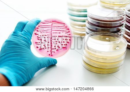 Colonies of bacteria in MacConkey agar (culture medium plate)