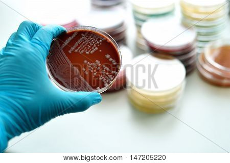Colonies of bacteria in blood agar (culture medium plate)