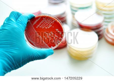 Colonies of bacteria in blood agar (culture medium plate)