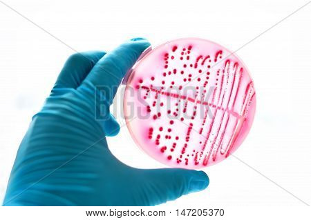 Colonies of bacteria in MacConkey agar (culture medium plate)