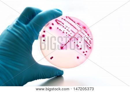 Colonies of bacteria in MacConkey agar (culture medium plate)