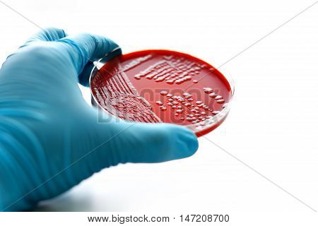 Colonies of bacteria in blood agar (culture medium plate)