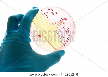 Colonies of bacteria in MacConkey agar (culture medium plate)
