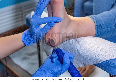 Master During A Pedicure. The Process Of Professional Pedicures. The Wizard In The Mask Causes The G
