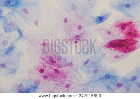 Squamous Epithelial Cells Under Microscope View For Education Histology. Human Tissue.