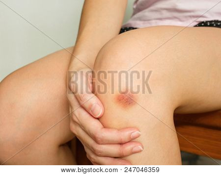 Woman's Got A Purple Bruise