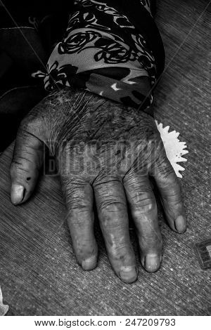 Two Hands Of An Old Woman On A Knees.wrinkles Of An Elderly Grandmother.hands Of An Old Woman With W