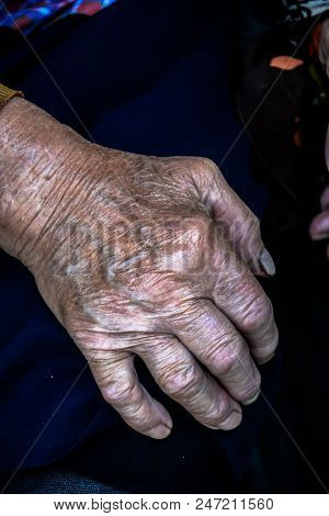 Two Hands Of An Old Woman On A Knees.wrinkles Of An Elderly Grandmother.hands Of An Old Woman With W