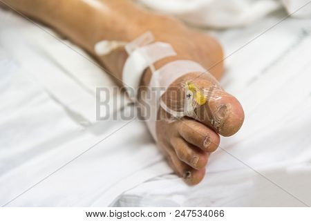 Patient With Saline Intravenous In The Hospital
