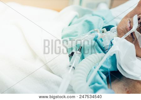 Patient Do Tracheostomy And Ventilator In Hospital