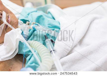 Patient Do Tracheostomy And Ventilator In Hospital